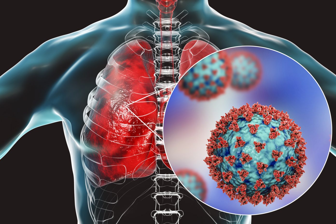 mapping-sars-cov-2-infections-in-the-respiratory-tract